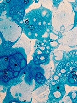 detail